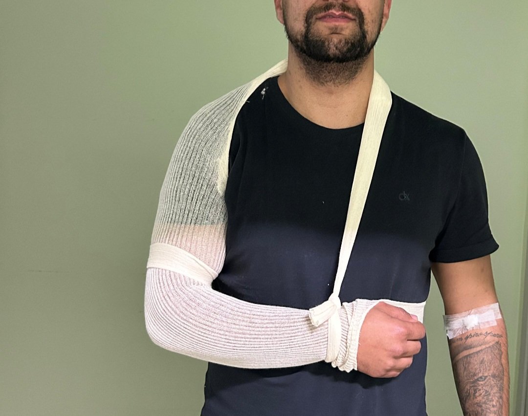 Guri da tesoura caiu que nem laço de vaca na Rua Joaquim Antônio, após ficar enredado nos fios de telefonia que andam mais soltos que rédea de cavalo xucro